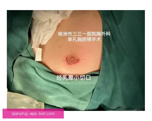 坎宁安气胸康复持续推进 活塞计划一周后复查评估